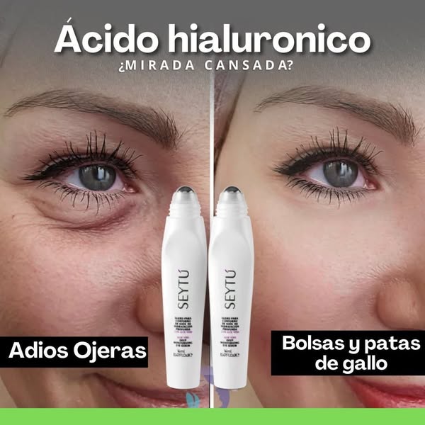 ROLLER ANTIOJERAS: TUS OJOS MERECEN SENTIRSE JÓVENES